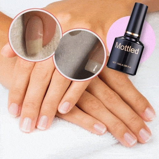 🌟2025 Schutzgel für Nagelreparatur💅 kaufen 1 Holen Sie sich 1 kostenlos