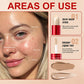 💗Mega-Angebot – 1+1 GRATIS🎁Zweifarbiger Langhaltiger Leichter Concealer